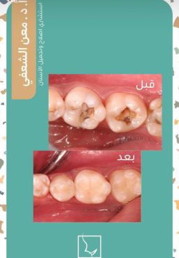 حالات سمايل (1)