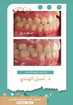 حالات سمايل (14)