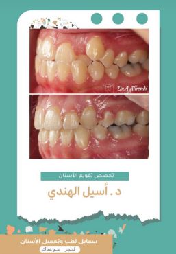 حالات سمايل (15)