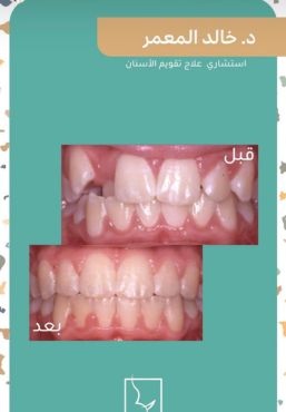 حالات سمايل (2)