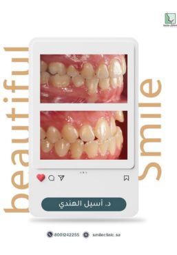 حالات سمايل (3)