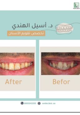 حالات سمايل (5)