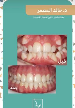 حالات سمايل (6)