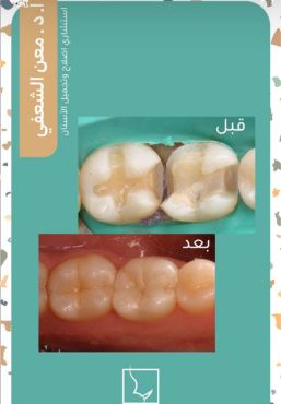 حالات سمايل